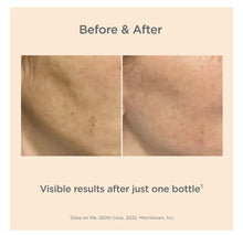 Load image into Gallery viewer, Melaclear Advanced